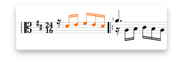 Anacrusis example